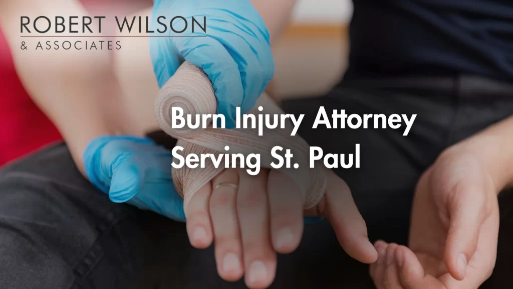 Burn Injury Attorney Serving St. Paul