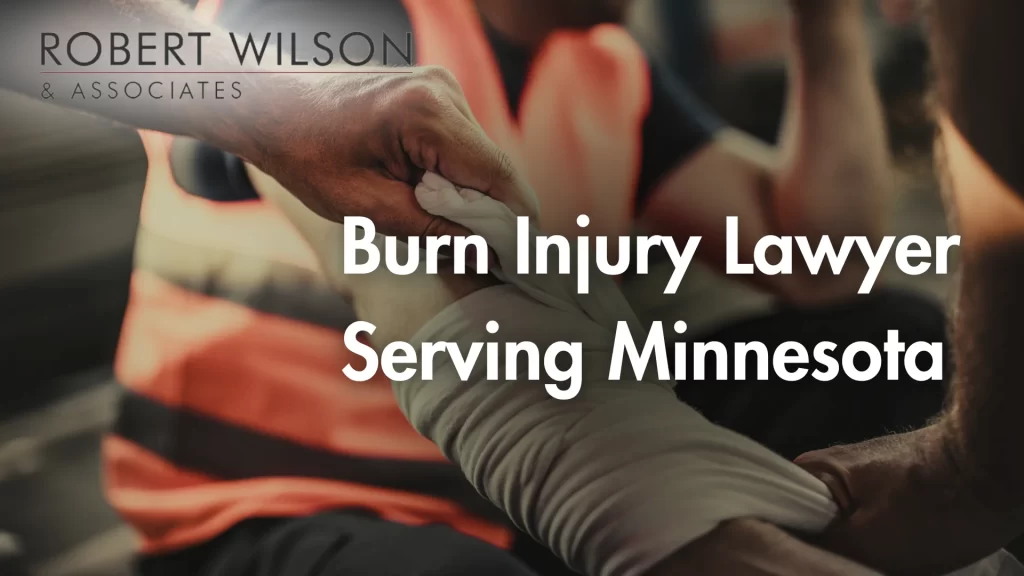 Burn Injury Lawyer Serving Minnesota